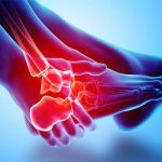 برای درد پا یا مچ پا باید به یک متخصص پا مراجعه کنم یا ارتوپد؟